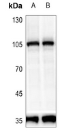 1 - Anti-PRKD2 (Phospho-S876) Antibody AP60370