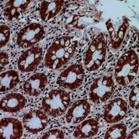 19 - Anti-Protein C Antibody AP60371