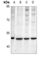 1 - Anti-Protein C Antibody AP60371