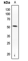 1 - Anti-PTEN (Phospho-S370) Antibody AP60372