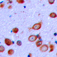 19 - Anti-PTHR1 Antibody AP60374