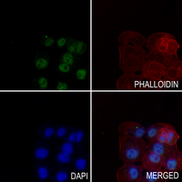 3 - Anti-Prothymosin alpha Antibody AP60375
