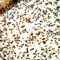 19 - Anti-Prothymosin alpha Antibody AP60375