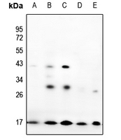 1 - Anti-Prothymosin alpha Antibody AP60375
