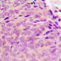 19 - Anti-PTP1B (Phospho-S50) Antibody AP60376