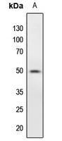 1 - Anti-PTP1B (Phospho-S50) Antibody AP60376