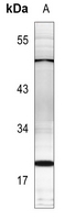 1 - Anti-PTTG1IP Antibody AP60377
