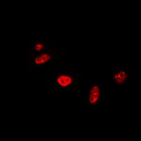 3 - Anti-RAD17 Antibody [KO/KD Validated] AP60378