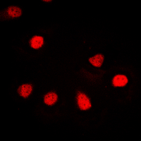 3 - Anti-hnRNP G Antibody AP60380