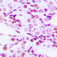 19 - Anti-hnRNP G Antibody AP60380