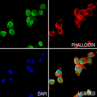 3 - Anti-NF-kappaB p65 (Phospho-T254) Antibody AP60381