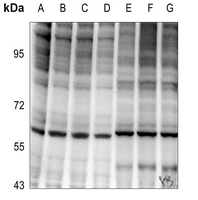 1 - Anti-NF-kappaB p65 (Phospho-T254) Antibody AP60381