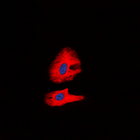 3 - Anti-RET (Phospho-Y1062) Antibody AP60382