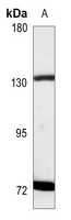 1 - Anti-ROR2 Antibody AP60385