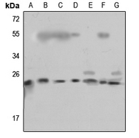 1 - Anti-RPL18 Antibody AP60386