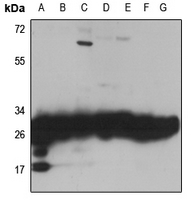 1 - Anti-RPL7 Antibody AP60388