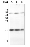 1 - Anti-RPLP2 Antibody AP60389
