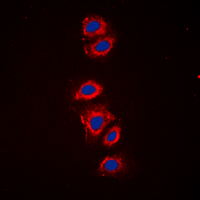 3 - Anti-RPS6 (Phospho-S240) Antibody AP60390
