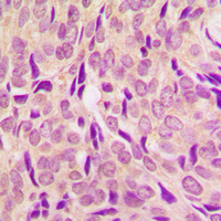 19 - Anti-RPS6 (Phospho-S240) Antibody AP60390