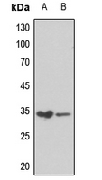 1 - Anti-RPS6 (Phospho-S240) Antibody AP60390