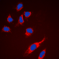 3 - Anti-RPS6 Antibody AP60391