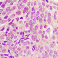 19 - Anti-RPS6 Antibody AP60391