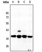 1 - Anti-RPS6 Antibody AP60391
