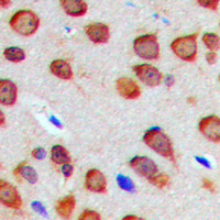 19 - Anti-Nogo Antibody AP60392