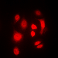 3 - Anti-SGK1/2 (Phospho-T256/253) Antibody AP60393