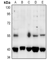 1 - Anti-SGK1/2 (Phospho-T256/253) Antibody AP60393