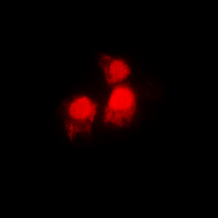 3 - Anti-SIAH2 Antibody AP60394