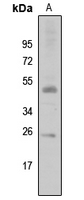 1 - Anti-SIAH2 Antibody AP60394