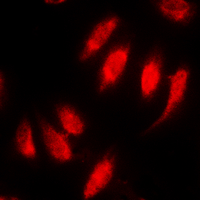 3 - Anti-SMAD2 (Phospho-S467) Antibody AP60396
