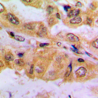 19 - Anti-SMAD2 (Phospho-S467) Antibody AP60396