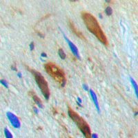 19 - Anti-SMAD3 (Phospho-T179) Antibody AP60397