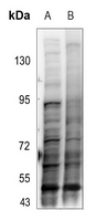 1 - Anti-SMAD3 (Phospho-T179) Antibody AP60397