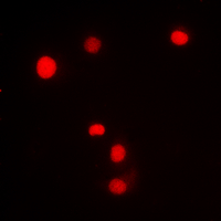 3 - Anti-SP1 (Phospho-T453) Antibody AP60398