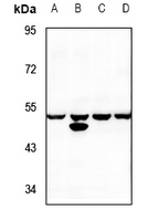 1 - Anti-MST3 Antibody AP60399