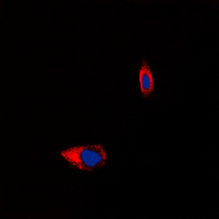 3 - Anti-Tachykinin Receptor 1 Antibody AP60400