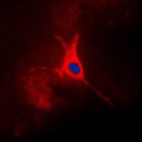 3 - Anti-TACSTD2 Antibody AP60401