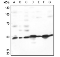 1 - Anti-TACSTD2 Antibody AP60401