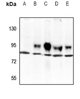1 - Anti-TBX3 Antibody AP60402