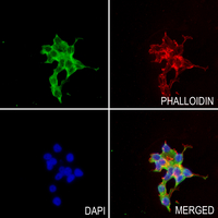 3 - Anti-Thrombospondin 2 Antibody AP60403