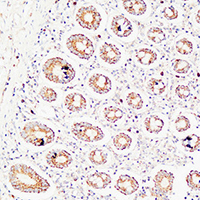 19 - Anti-Thrombospondin 2 Antibody AP60403