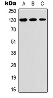 1 - Anti-Thrombospondin 2 Antibody AP60403