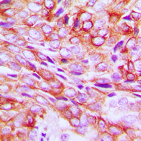 19 - Anti-TMBIM1 Antibody AP60404
