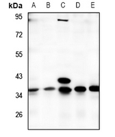 1 - Anti-TMBIM1 Antibody AP60404