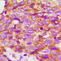 19 - Anti-ECHOS1 Antibody AP60405