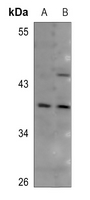 1 - Anti-CD134 Antibody AP60406