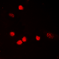 3 - Anti-p53 (Acetyl-K319) Antibody AP60409